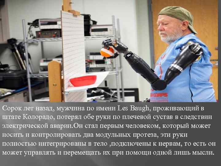 Сорок лет назад, мужчина по имени Les Baugh, проживающий в штате Колорадо, потерял обе