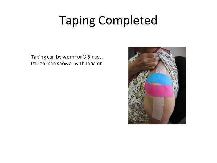 Taping Completed Taping can be worn for 3 -5 days. Patient can shower with