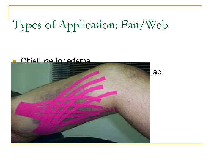 Types of Application: Fan/Web n n Chief use for edema Web different because ends