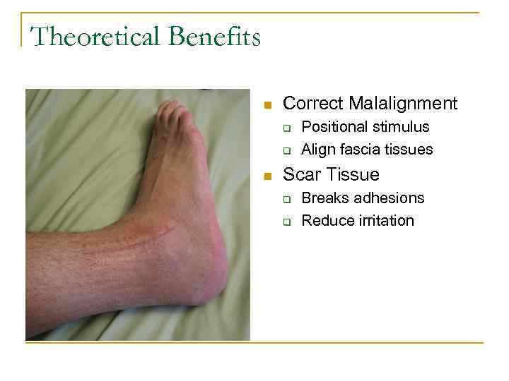 Theoretical Benefits n Correct Malalignment q q n Positional stimulus Align fascia tissues Scar