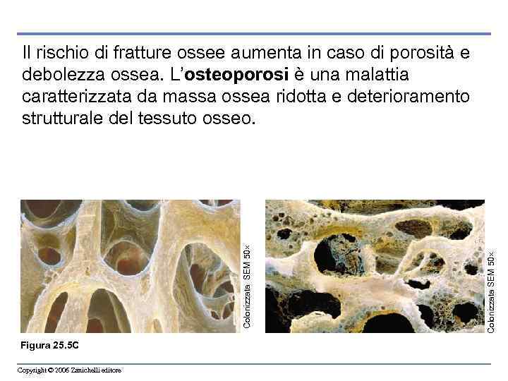 Figura 25. 5 C Copyright © 2006 Zanichelli editore Colonizzata SEM 50 Il rischio