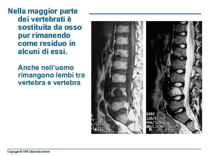 Nella maggior parte dei vertebrati è sostituita da osso pur rimanendo come residuo in