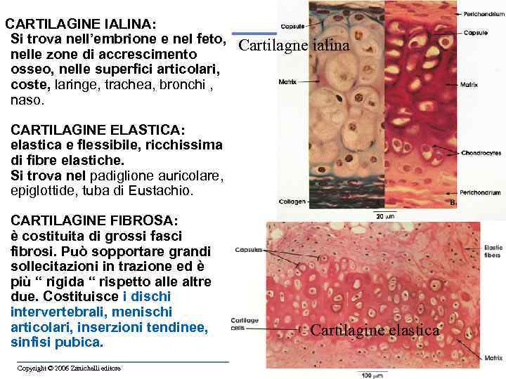 CARTILAGINE IALINA: Si trova nell’embrione e nel feto, nelle zone di accrescimento osseo, nelle