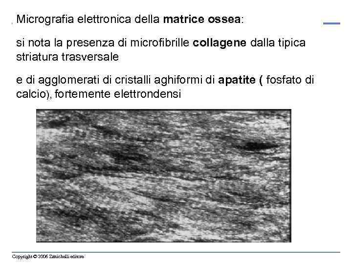 Micrografia elettronica della matrice ossea: si nota la presenza di microfibrille collagene dalla tipica