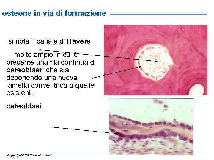 osteone in via di formazione si nota il canale di Havers molto ampio in