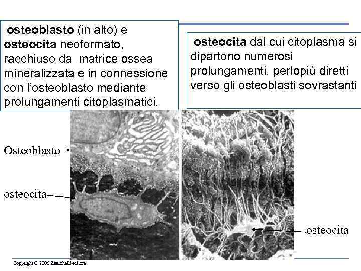  osteoblasto (in alto) e osteocita neoformato, racchiuso da matrice ossea mineralizzata e in