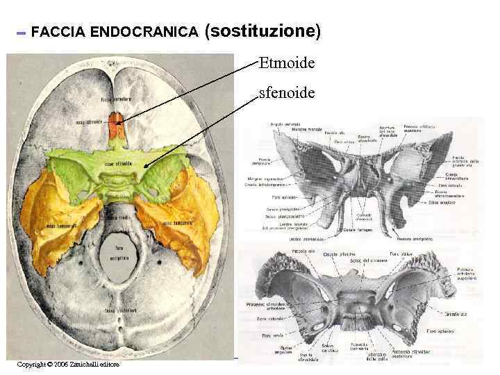 FACCIA ENDOCRANICA (sostituzione) Etmoide sfenoide Copyright © 2006 Zanichelli editore 