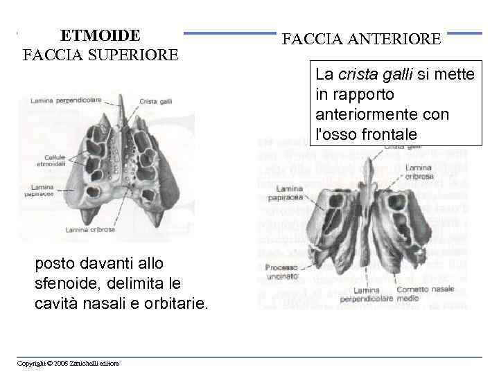 ETMOIDE FACCIA SUPERIORE FACCIA ANTERIORE La crista galli si mette in rapporto anteriormente con