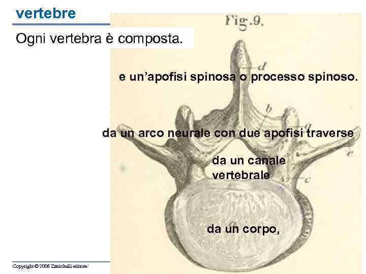 vertebre Ogni vertebra è composta. e un’apofisi spinosa o processo spinoso. da un arco