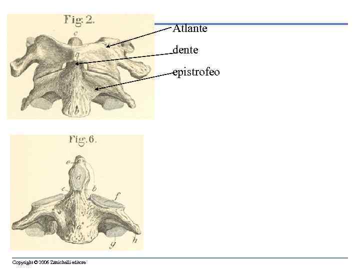 Atlante dente epistrofeo Copyright © 2006 Zanichelli editore 