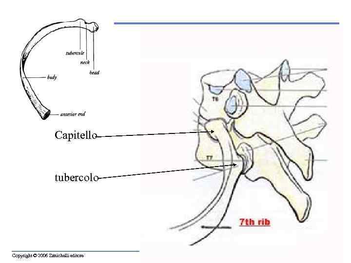 Capitello tubercolo Copyright © 2006 Zanichelli editore 