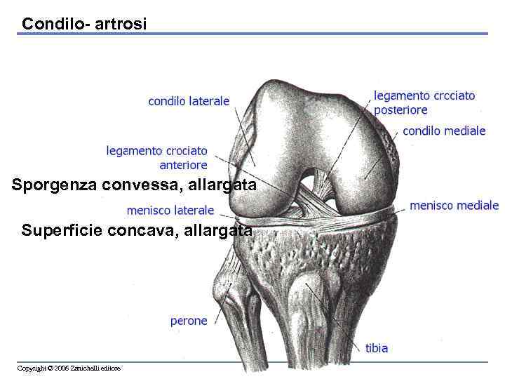 Condilo- artrosi Sporgenza convessa, allargata Superficie concava, allargata Copyright © 2006 Zanichelli editore 