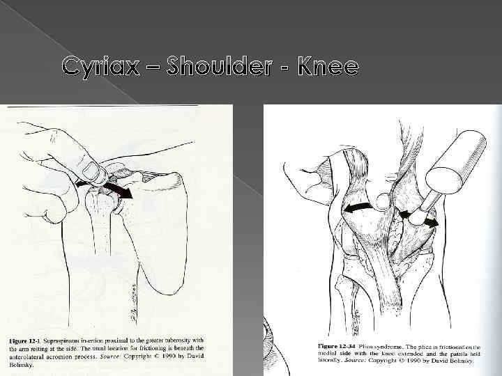 Cyriax – Shoulder - Knee 