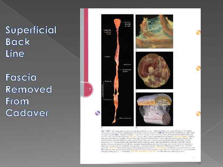 Superficial Back Line Fascia Removed From Cadaver 