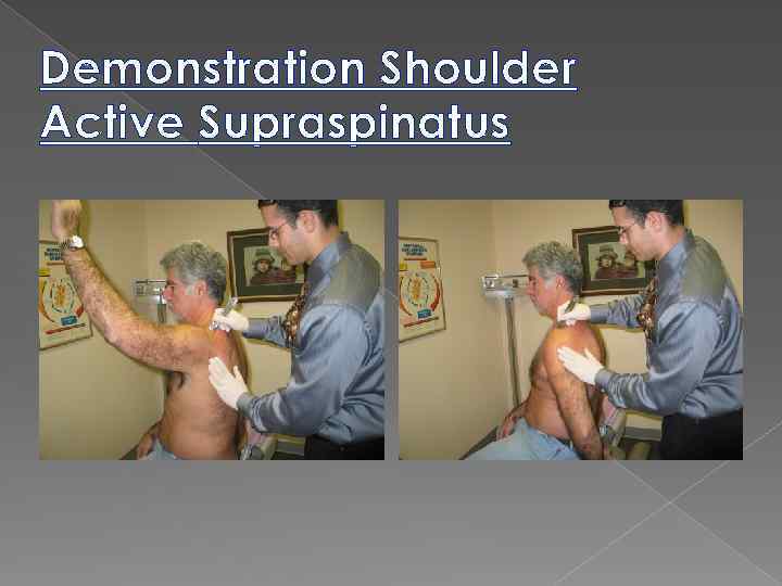 Demonstration Shoulder Active Supraspinatus 
