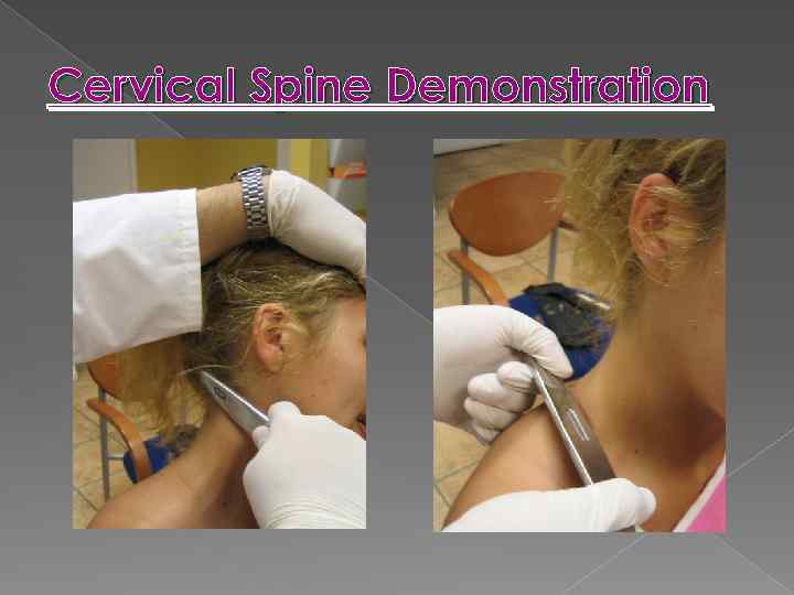 Cervical Spine Demonstration 