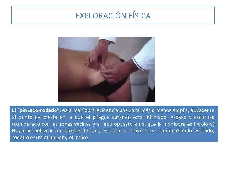 EXPLORACIÓN FÍSICA El “pinzado-rodado”: esta maniobra evidencia una zona más o menos amplia, adyacente