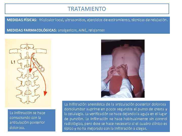 TRATAMIENTO MEDIDAS FÍSICAS: frío/calor local, ultrasonidos, ejercicios de estiramiento, técnicas de relajación. MEDIDAS FARMACOLÓGICAS: