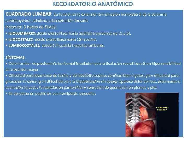 RECORDATORIO ANATÓMICO CUADRADO LUMBAR Su función es la extensión e inclinación homolateral de la