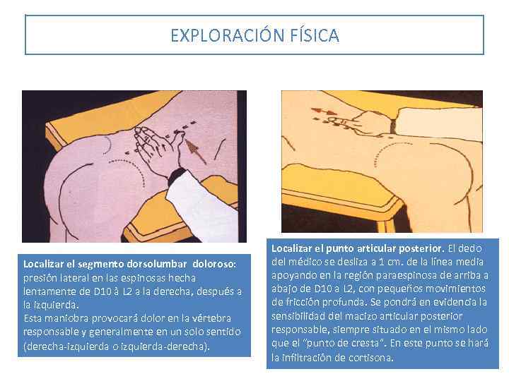 EXPLORACIÓN FÍSICA Localizar el segmento dorsolumbar doloroso: presión lateral en las espinosas hecha lentamente