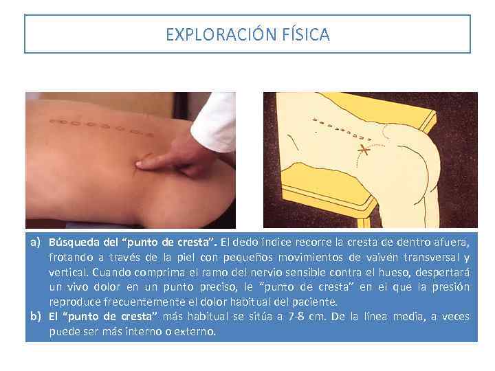 EXPLORACIÓN FÍSICA a) Búsqueda del “punto de cresta”. El dedo índice recorre la cresta