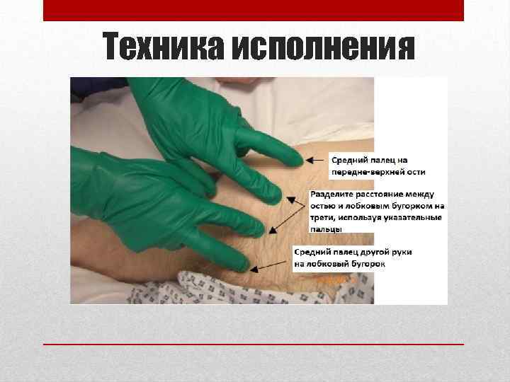 Техника исполнения 