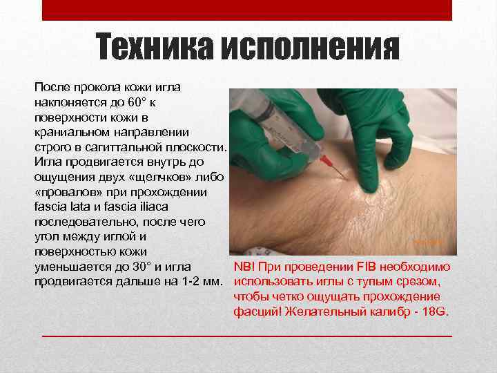 Техника исполнения После прокола кожи игла наклоняется до 60° к поверхности кожи в краниальном