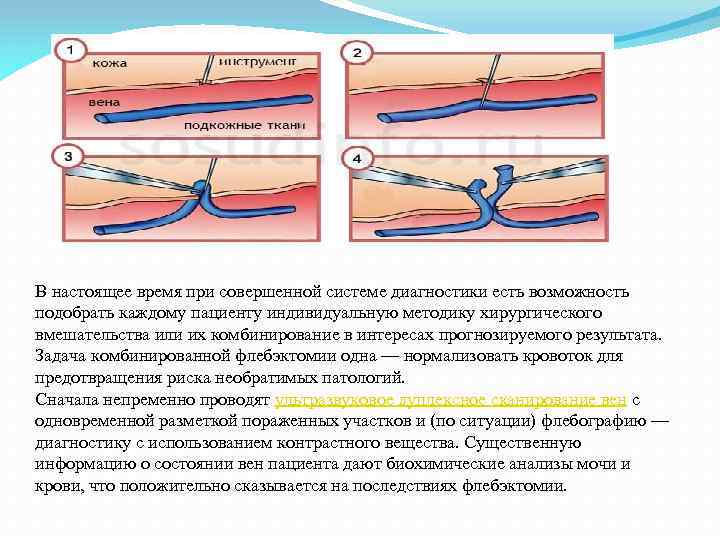 В настоящее время при совершенной системе диагностики есть возможность подобрать каждому пациенту индивидуальную методику