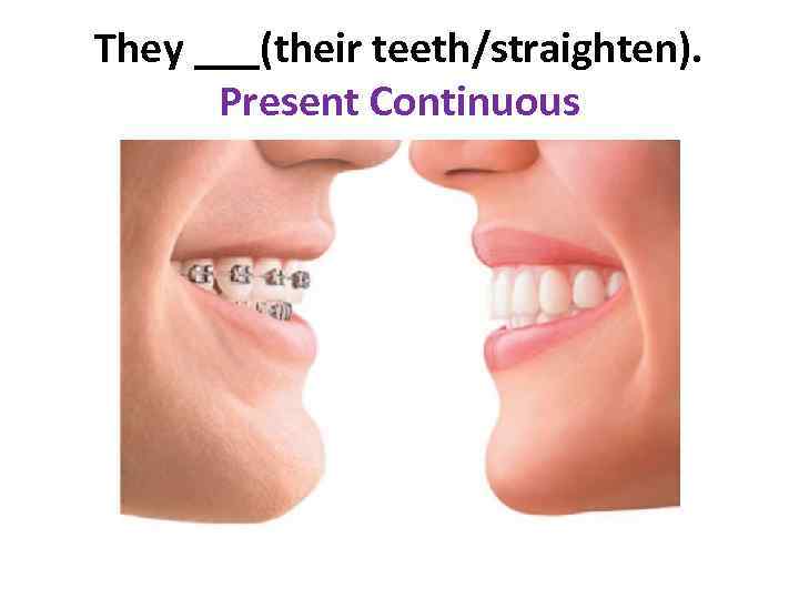They ___(their teeth/straighten). Present Continuous 