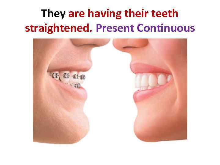 They are having their teeth straightened. Present Continuous 