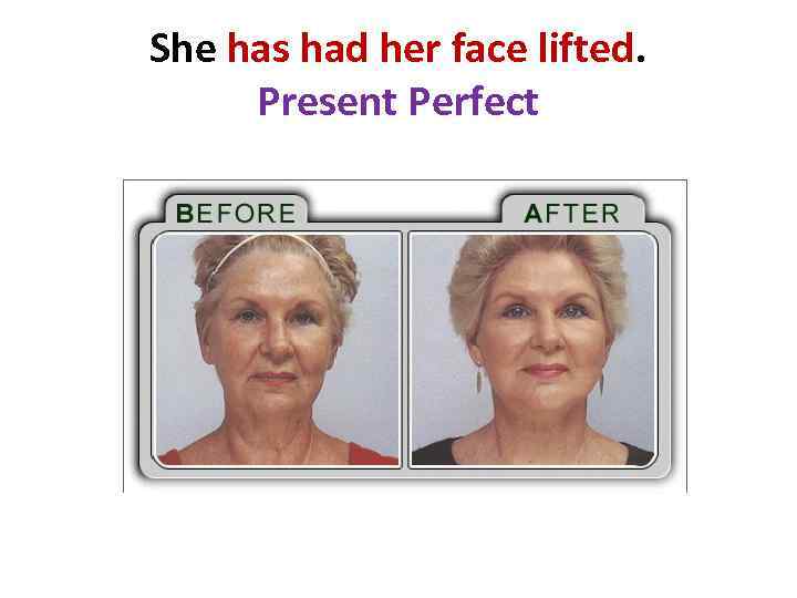 She has had her face lifted. Present Perfect 