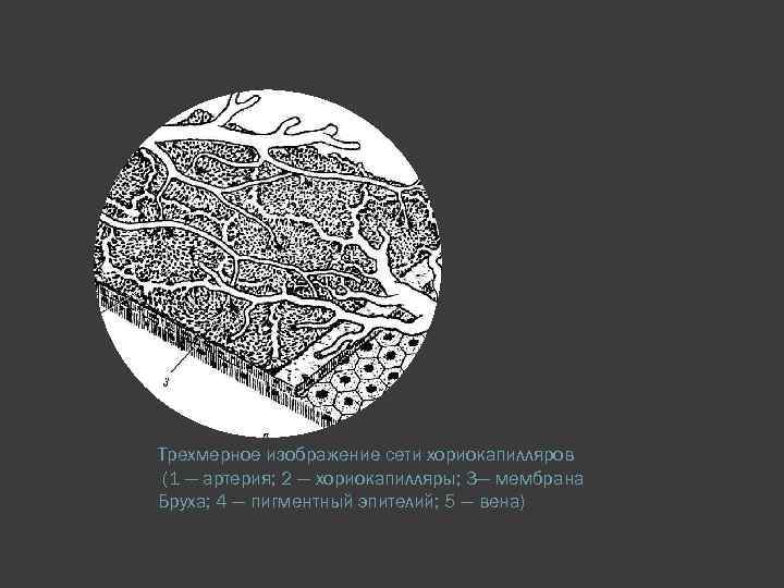 Трехмерное изображение сети хориокапилляров (1 — артерия; 2 — хориокапилляры; 3— мембрана Бруха; 4