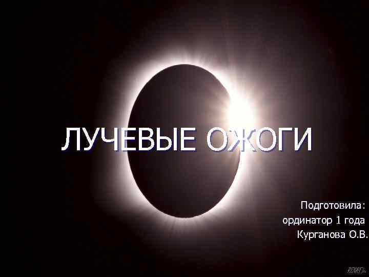 ЛУЧЕВЫЕ ОЖОГИ Подготовила: ординатор 1 года Курганова О. В. 