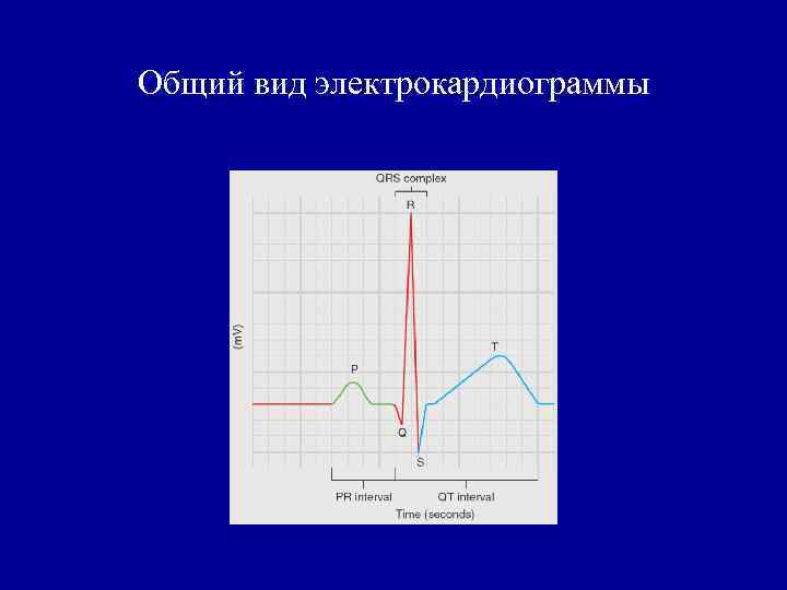 Общий вид электрокардиограммы 