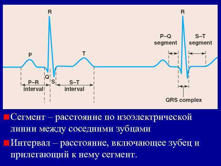 Сегмент – расстояние по изоэлектрической линии между соседними зубцами Интервал – расстояние, включающее зубец