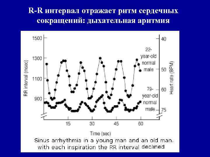 R-R интервал отражает ритм сердечных сокращений: дыхательная аритмия 