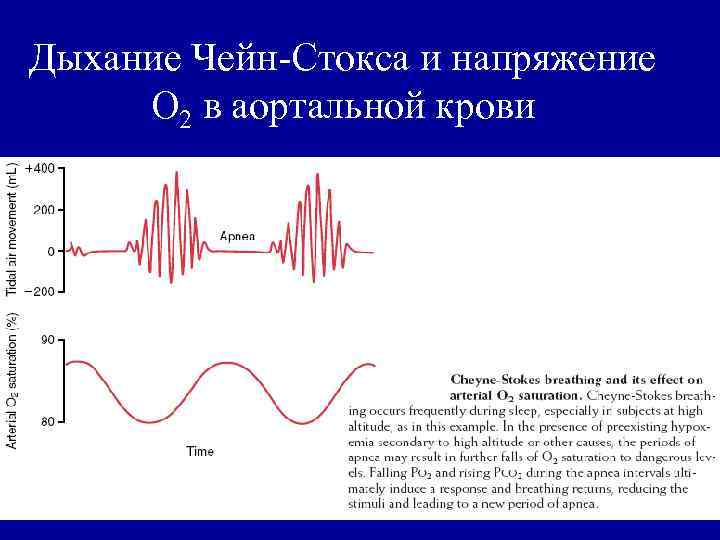 Дыхание чейна стокса схема