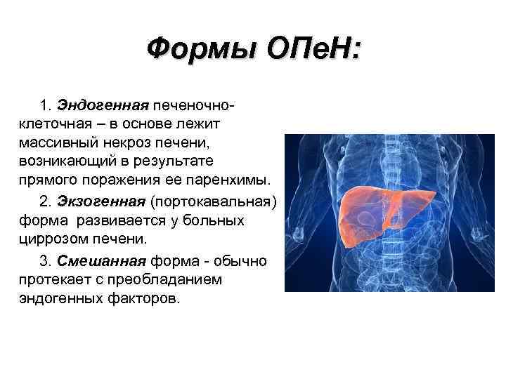 Формы ОПе. Н: 1. Эндогенная печеночноклеточная – в основе лежит массивный некроз печени, возникающий