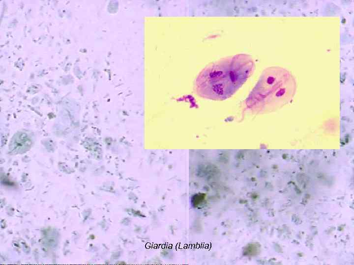 Giardia (Lamblia) 