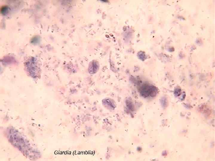 Giardia (Lamblia) 