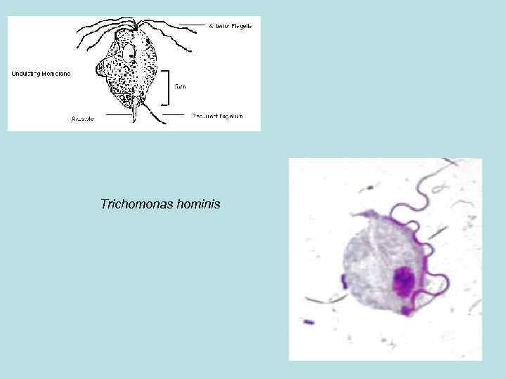 Трихомонада кишечная. Органеллы движения трихомонады. Трихомонада Hominis рисунок. Кишечная трихомонада Trichomonas Hominis. Органоиды передвижения трихомонады.