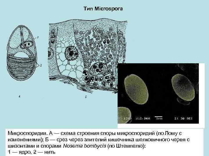 Тип Microspora Микроспоридии. А — схема строения споры микроспоридий (по Лому с изменениями); Б