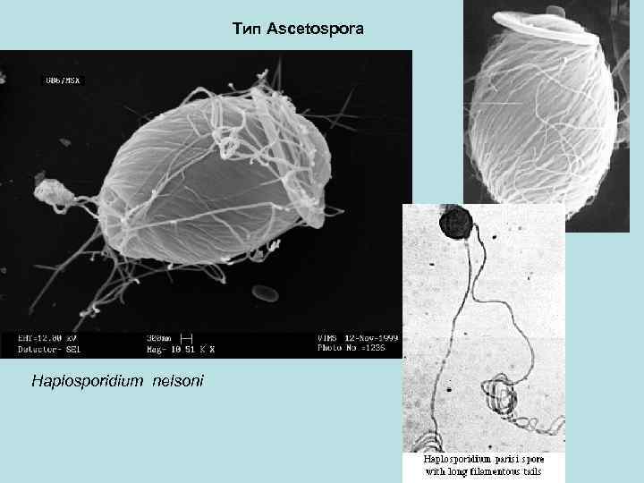 Тип Ascetospora Haplosporidium nelsoni 