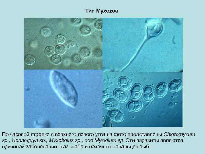 Тип Myxozoa По часовой стрелке с верхнего левого угла на фото представлены Chloromyxum sp.