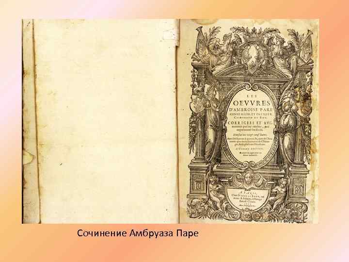 Сочинение Амбруаза Паре 