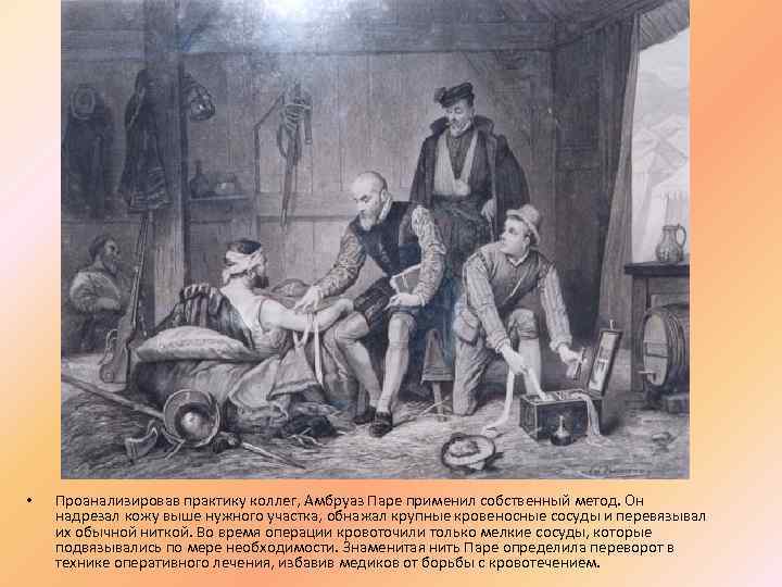  • Проанализировав практику коллег, Амбруаз Паре применил собственный метод. Он надрезал кожу выше