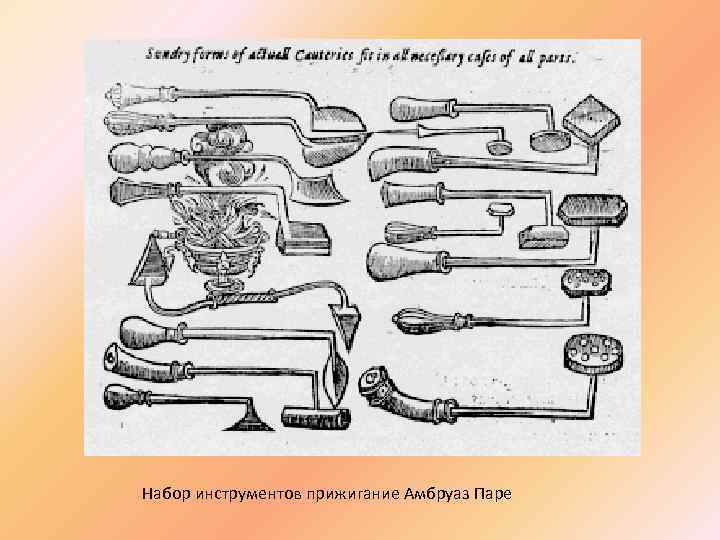 Набор инструментов прижигание Амбруаз Паре 