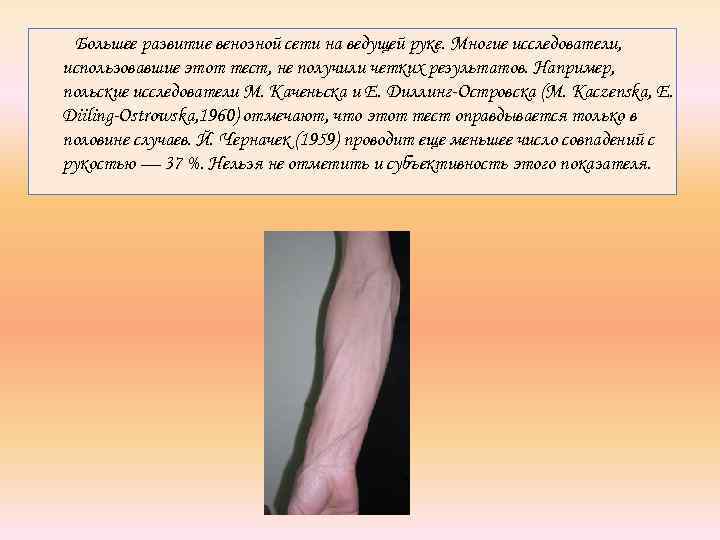 Большее развитие венозной сети на ведущей руке. Многие исследователи, использовавшие этот тест, не получили