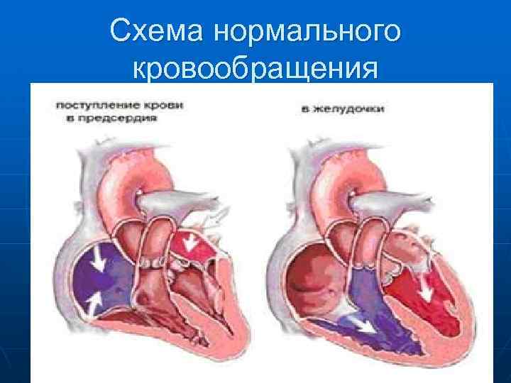 Схема нормального кровообращения 