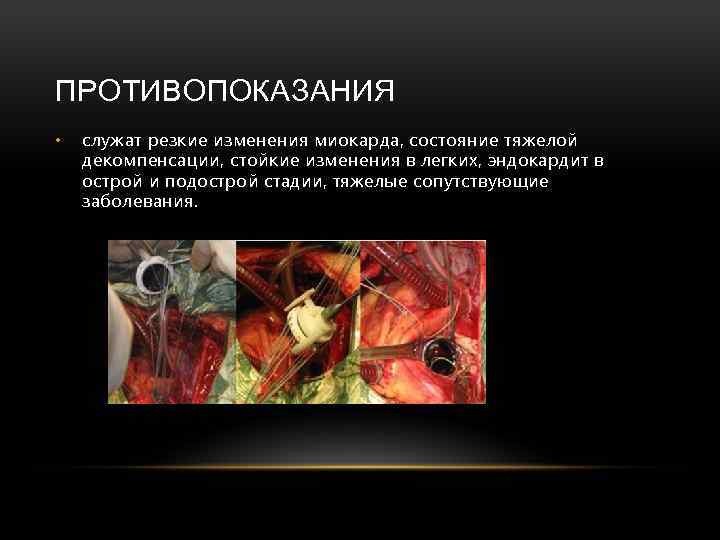 ПРОТИВОПОКАЗАНИЯ • служат резкие изменения миокарда, состояние тяжелой декомпенсации, стойкие изменения в легких, эндокардит